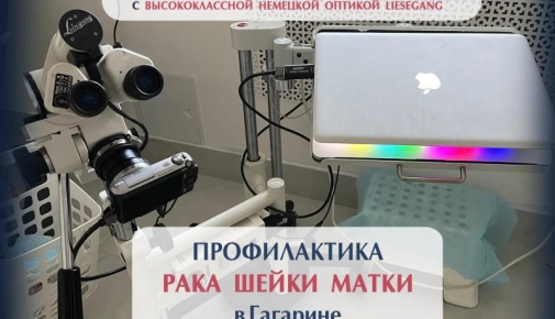 Кольпоскопия в городе Гагарин