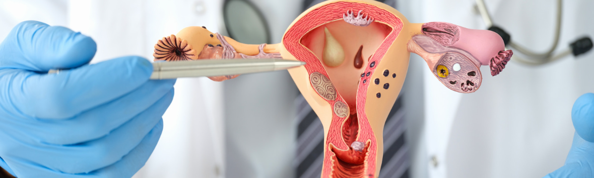 Гинекология